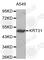 Keratin 31 antibody, A2663, ABclonal Technology, Western Blot image 