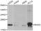 Ras Homolog Family Member C antibody, abx000985, Abbexa, Western Blot image 