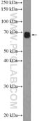TOX High Mobility Group Box Family Member 2 antibody, 21162-1-AP, Proteintech Group, Western Blot image 
