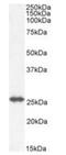 Glutathione S-Transferase Mu 4 antibody, orb1825, Biorbyt, Western Blot image 