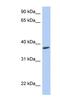 Radial Spoke Head 14 Homolog antibody, NBP1-56596, Novus Biologicals, Western Blot image 