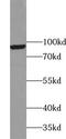 Ubiquitin Specific Peptidase 13 antibody, FNab09308, FineTest, Western Blot image 