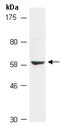 Cyclic GMP-AMP Synthase antibody, R3252-1, Abiocode, Western Blot image 