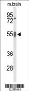Growth Factor Receptor Bound Protein 7 antibody, 63-960, ProSci, Western Blot image 