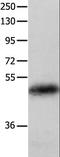 Keratin, type I cytoskeletal 23 antibody, LS-C403833, Lifespan Biosciences, Western Blot image 