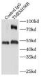 Transmembrane Protein 106B antibody, FNab08744, FineTest, Immunoprecipitation image 