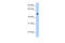 Solute Carrier Family 35 Member F5 antibody, 29-940, ProSci, Western Blot image 