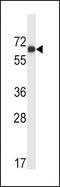 Megakaryocyte-Associated Tyrosine Kinase antibody, PA5-14785, Invitrogen Antibodies, Western Blot image 