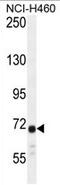 Ataxin 7 Like 2 antibody, AP50313PU-N, Origene, Western Blot image 