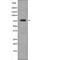 Protein Kinase C Theta antibody, abx217946, Abbexa, Western Blot image 