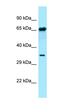 ADP Ribosylation Factor GTPase Activating Protein 3 antibody, orb331154, Biorbyt, Western Blot image 