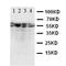 Fc Fragment Of IgA Receptor antibody, orb48016, Biorbyt, Western Blot image 