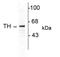 Tyrosine Hydroxylase antibody, AHP1879, Bio-Rad (formerly AbD Serotec) , Immunohistochemistry frozen image 