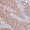 MLC-2 antibody, PA5-54073, Invitrogen Antibodies, Immunohistochemistry paraffin image 