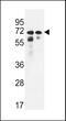 Calcium-independent phospholipase A2-gamma antibody, 61-632, ProSci, Western Blot image 