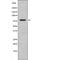 Eukaryotic Translation Initiation Factor 2B Subunit Epsilon antibody, PA5-64620, Invitrogen Antibodies, Western Blot image 