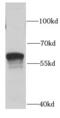 N-Sulfoglucosamine Sulfohydrolase antibody, FNab07813, FineTest, Western Blot image 
