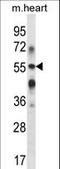 Beta-1,3-Galactosyltransferase 2 antibody, LS-C156703, Lifespan Biosciences, Western Blot image 