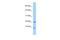 Transcription Elongation Factor A Like 7 antibody, A13038, Boster Biological Technology, Western Blot image 