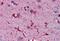 Ferritin Light Chain antibody, MBS243685, MyBioSource, Immunohistochemistry paraffin image 