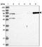 Signal Transducer And Activator Of Transcription 5A antibody, NBP1-81051, Novus Biologicals, Western Blot image 