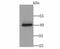 Calcium Voltage-Gated Channel Auxiliary Subunit Gamma 4 antibody, NBP2-76920, Novus Biologicals, Western Blot image 