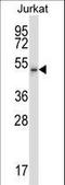 Cyclin Dependent Kinase 15 antibody, LS-C164326, Lifespan Biosciences, Western Blot image 