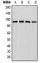 Leucine Zipper Like Transcription Regulator 1 antibody, GTX55179, GeneTex, Western Blot image 