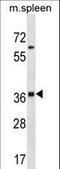 Inhibin Subunit Alpha antibody, LS-C158220, Lifespan Biosciences, Western Blot image 