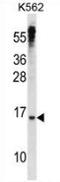 MAX Dimerization Protein 3 antibody, AP52781PU-N, Origene, Western Blot image 