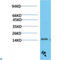 Transthyretin antibody, LS-C813243, Lifespan Biosciences, Western Blot image 