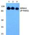 ATM Serine/Threonine Kinase antibody, A00014S1987, Boster Biological Technology, Western Blot image 