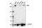 SWI/SNF Related, Matrix Associated, Actin Dependent Regulator Of Chromatin, Subfamily A, Member 4 antibody, 52251S, Cell Signaling Technology, Western Blot image 