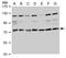 Transforming Acidic Coiled-Coil Containing Protein 2 antibody, PA5-22119, Invitrogen Antibodies, Western Blot image 