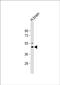 Potassium Voltage-Gated Channel Subfamily J Member 2 antibody, PA5-72498, Invitrogen Antibodies, Western Blot image 