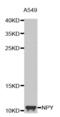 Neuropeptide Y antibody, abx002280, Abbexa, Western Blot image 
