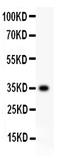 CD63 Molecule antibody, PB9250, Boster Biological Technology, Western Blot image 