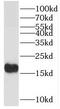 Tubulin Polymerization Promoting Protein Family Member 2 antibody, FNab08899, FineTest, Western Blot image 