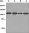 Insulin Degrading Enzyme antibody, ab133561, Abcam, Western Blot image 