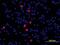 S100 Calcium Binding Protein A8 antibody, AF3059, R&D Systems, Immunofluorescence image 