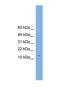 Complexin 2 antibody, NBP1-57001, Novus Biologicals, Western Blot image 