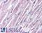Toll Like Receptor 2 antibody, LS-B1417, Lifespan Biosciences, Immunohistochemistry paraffin image 
