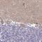 Tripartite Motif Containing 64C antibody, NBP2-14548, Novus Biologicals, Immunohistochemistry paraffin image 