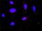 Coagulation Factor II, Thrombin antibody, H00002147-M01, Novus Biologicals, Proximity Ligation Assay image 