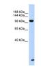 Trinucleotide Repeat Containing Adaptor 6B antibody, NBP1-57461, Novus Biologicals, Western Blot image 