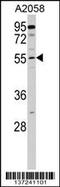 Carnosine Dipeptidase 2 antibody, 58-958, ProSci, Western Blot image 