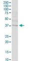 SET Domain And Mariner Transposase Fusion Gene antibody, H00006419-B01P, Novus Biologicals, Western Blot image 