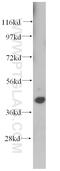 Dual Specificity Phosphatase 9 antibody, 14484-1-AP, Proteintech Group, Western Blot image 