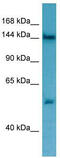 Tripeptidyl Peptidase 2 antibody, TA338236, Origene, Western Blot image 