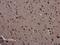 SMAD Family Member 4 antibody, PA5-34806, Invitrogen Antibodies, Immunohistochemistry frozen image 